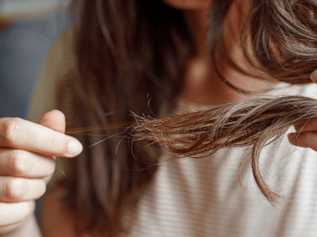Perte soudaine et sévère de cheveux chez les femmes