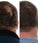 Foligain hair loss shampoo men (236 ml) - Hairgivers