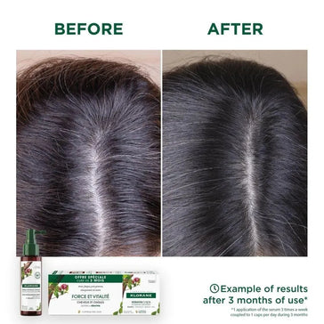 Klorane behandling mod hårtab Klorane anti-hair loss treatment - Hairgivers
