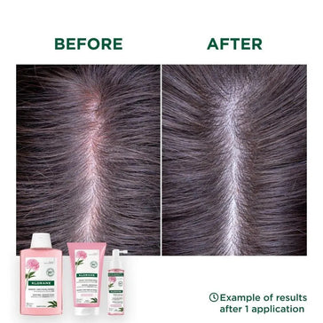 Tratamento Klorane para couro cabeludo sensível Klorane treatment for sensitive scalp - Hairgivers