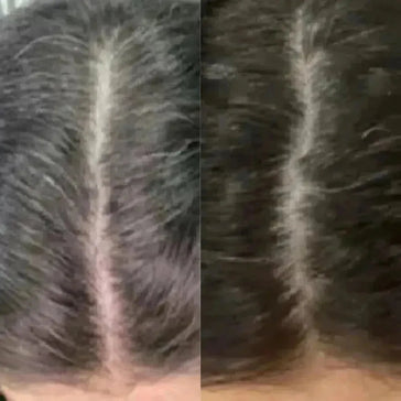Neofollics comprimidos anti-cinzento (embalagem com 3) Neofollics anti-grey hair tablets (3-pack) - Hairgivers
