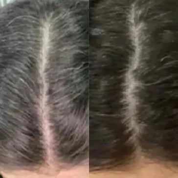 Neofollics anti-grey hair tablets Neofollics anti-grey hair tablets - Hairgivers