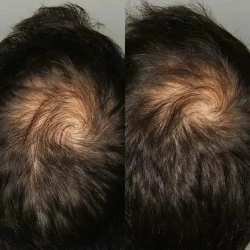 Comprimidos de crescimento capilar Viviscal para homem (3 meses) Viviscal hair growth tablets for men (3 months) - Hairgivers