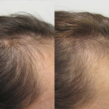 Viviscal hårvæksttabletter til kvinder (1 måned) Viviscal hair growth tablets for women (1 month) - Hairgivers