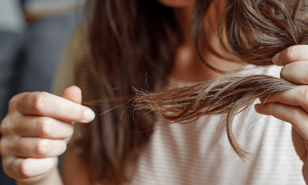 Sudden severe hair loss in women
