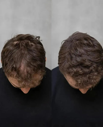 3x Keratain hair fibers + free Keratain pomade – Light brown (25 gr) - Hairgivers