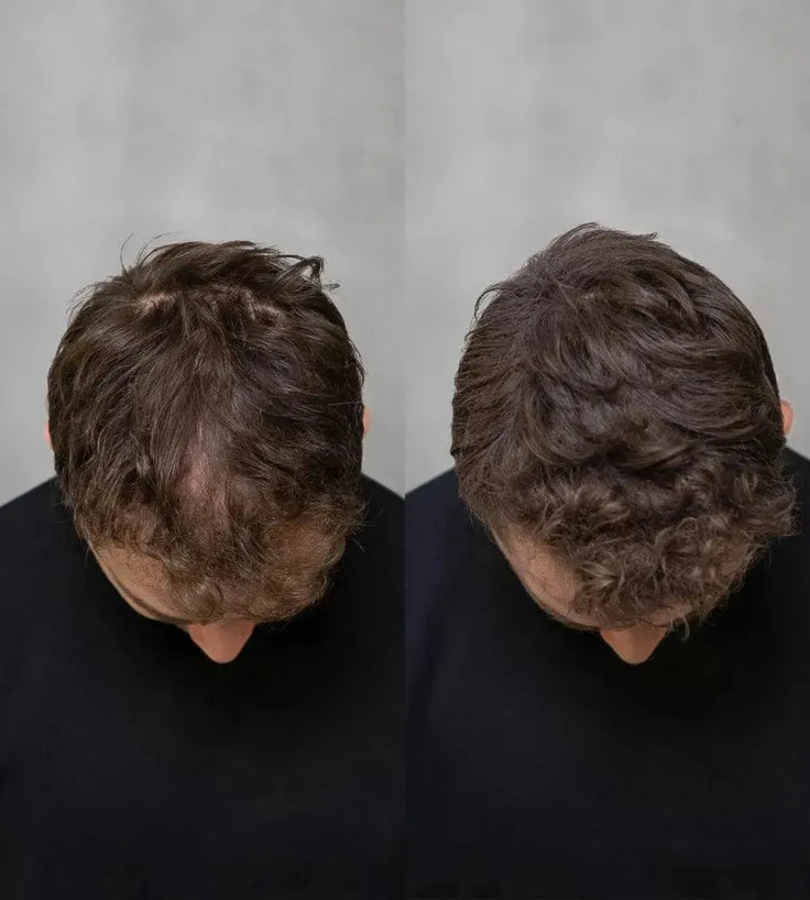 3x Keratain hair fibers + free Keratain pomade – Light brown (25 gr) - Hairgivers