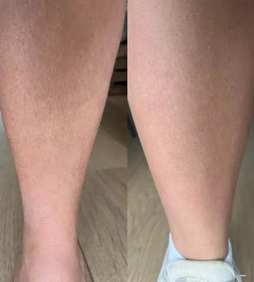 Keramene body hair minimizer depilatory cream - Hair Growth Specialist