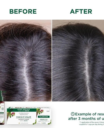 Klorane anti-hair loss serum Quinine/Edelweiss (100 ml) - Hairgivers