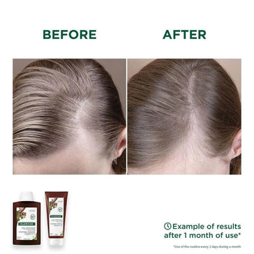 Klorane anti-hair loss shampoo + conditioner - Hairgivers