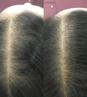 Revita conditioner (205 ml) - Hair Growth Specialist