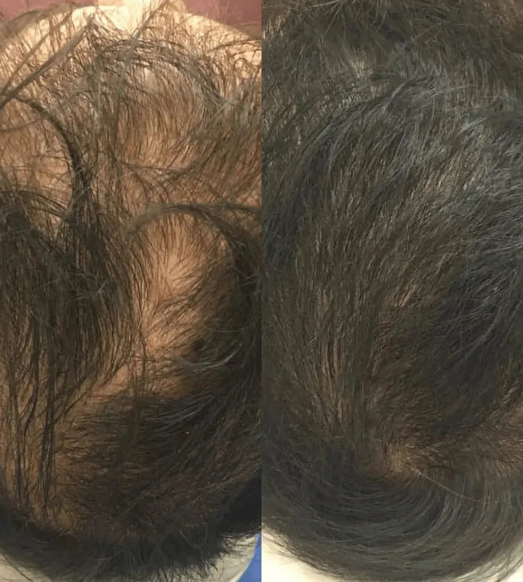 Revita hair growth shampoo (925 ml) - Hairgivers