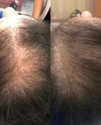 Spectral.CSF (Adenosine) lotion - Hairgivers