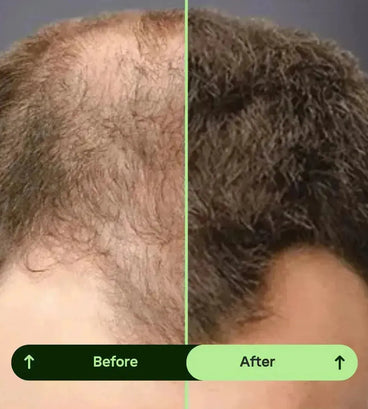 Toppik hair thickener color spray - black - Hair Growth Specialist