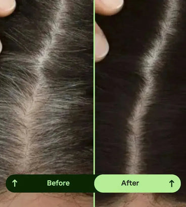 Toppik hair thickener color spray - black - Hair Growth Specialist