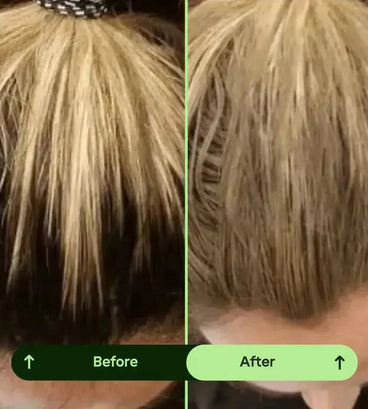 Toppik hair thickener color spray - black - Hair Growth Specialist